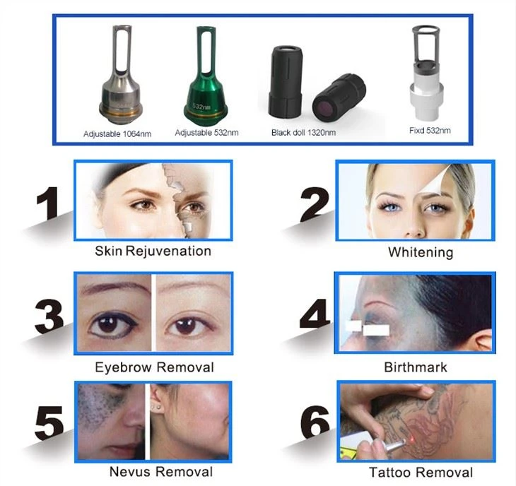 Q Switched Laser Tattoo Removal Skin Whitening Machine