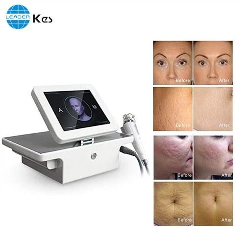 Rf Microneedle Rf Microneedling Machine Salon Użyj przenośnego ułamkowego liftingu twarzy Rf Microneedle Equipo