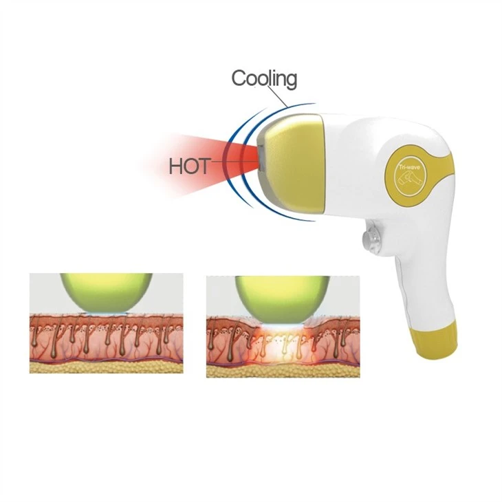 Diode Laser 755/808/1064nm Hair Removal Machine