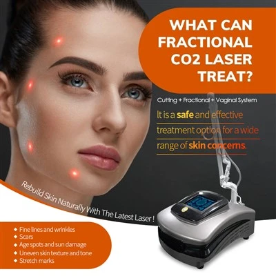 Najnowsza laserowa maszyna CO2 Resurfacing